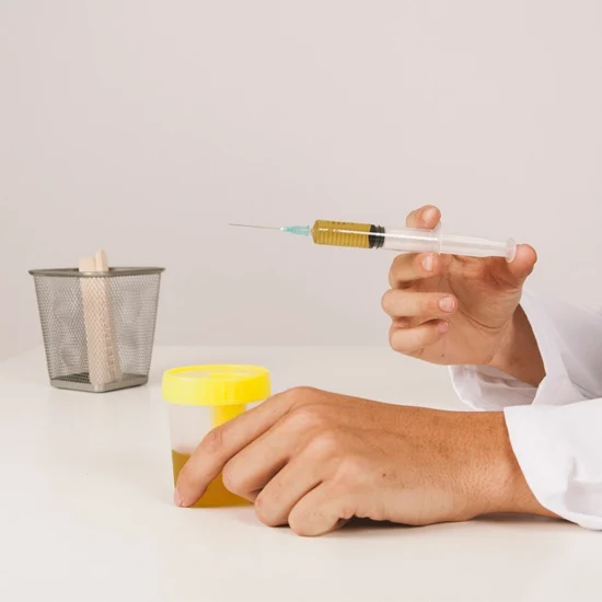 24 hour urine microprotein test